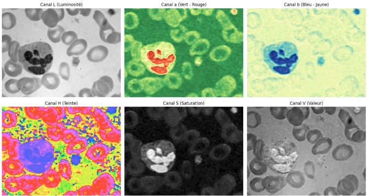 Blood Cell Detection & Counting